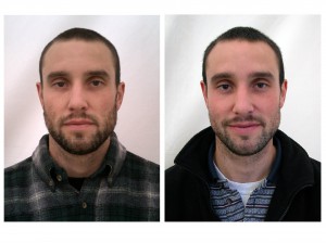 06beforeafterF-300x224